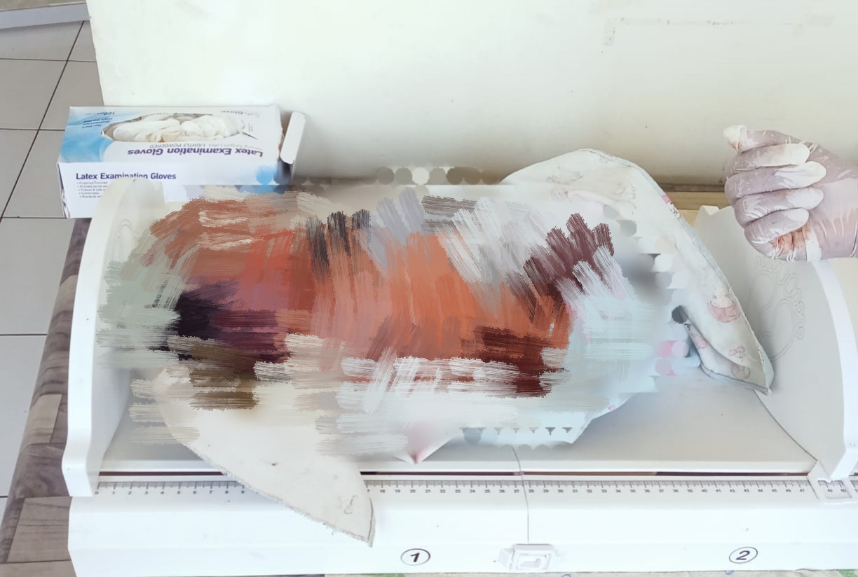 Ket. Foto: Seorang Bayi Laki-laki Tak Berdosa Mengakhiri Hidupnya.