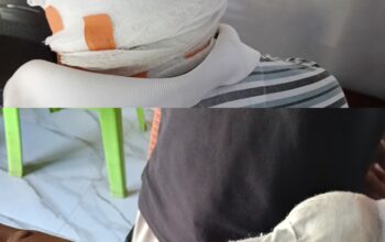 Miris!!! Seorang PPPK, dan Anggota BPD Aniaya 2 Warga Desa Kuaklalo
