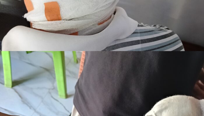 Miris!!! Seorang PPPK, dan Anggota BPD Aniaya 2 Warga Desa Kuaklalo